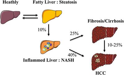 Natural Killer Cells and Type 1 Innate Lymphoid Cells Are New Actors in Non-alcoholic Fatty Liver Disease